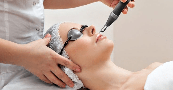 How Laser Technology is Redefining Acne Treatment